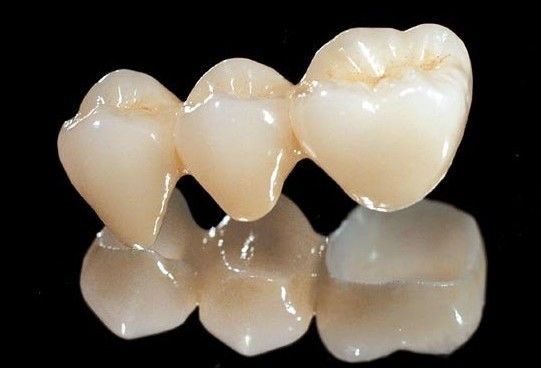 Alle keramisches Zirkoniumdioxid-zahnmedizinische Krone