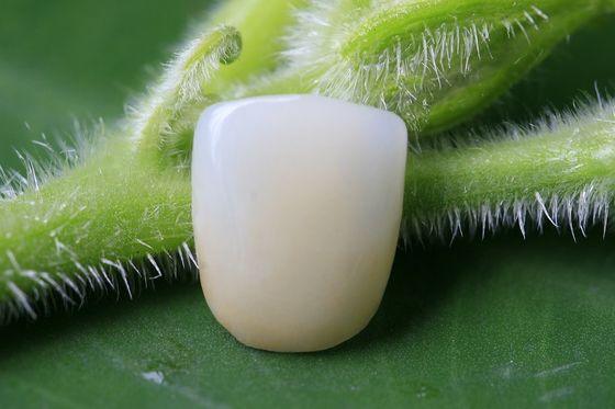 Volle keramische Biocompatible EMAX zahnmedizinische Krone der großen Eignungs-
