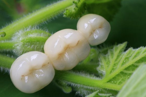 Alle keramisches Zirkoniumdioxid-zahnmedizinische Krone