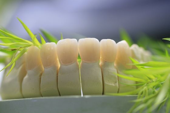 Zahnmedizinischer Laborörtlich festgelegter Prosthetics überlagerte Zirkoniumdioxid-zahnmedizinische Krone für Front Teeth