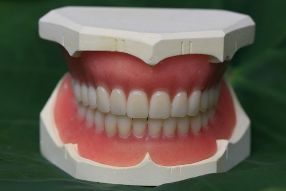 Acrylteilprothese der Immediatprothese-ISO13485