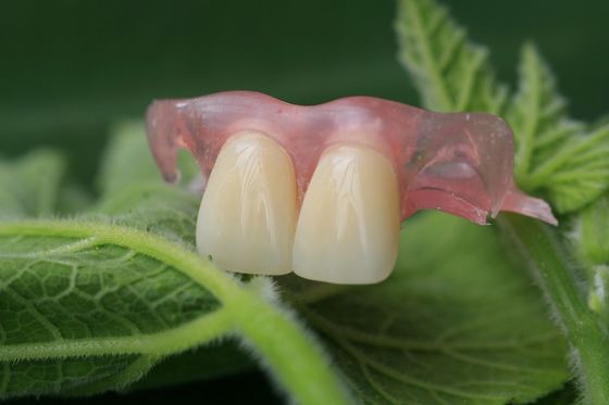 Flexibles unsichtbares Gebiss