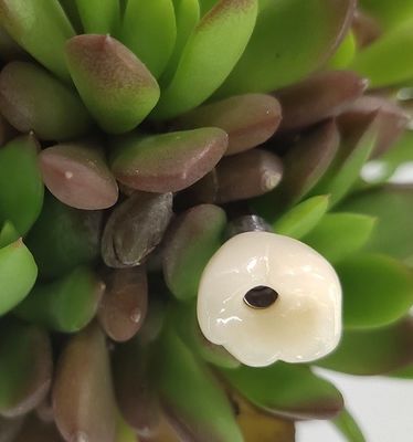 Schraube behaltene Befestigungs-Niveau-Zahnimplantate krönen