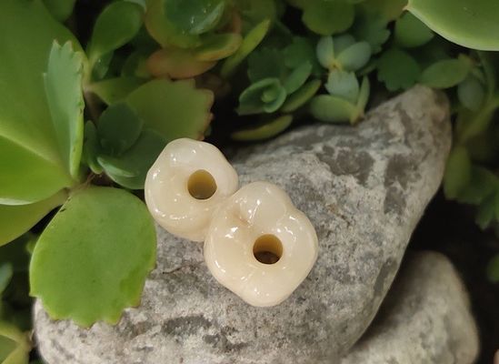 Schraube behaltene Befestigungs-Niveau-Zahnimplantate krönen