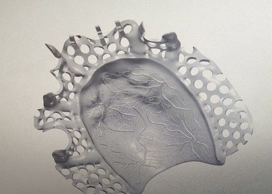 Cad-Entwurfs-Titanlegierungs-Teilprothese-Metallrahmen