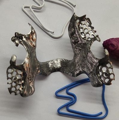 Casted-Mandibularbogen-Teilprothese-Metallrahmen
