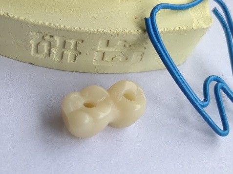Cad-Nocken-Entwurfs-zahnmedizinischer Druck 3D