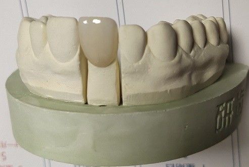 Zirkoniumdioxid blockiert zahnmedizinischen Druck 3D, indem es CAD-Nocken mahlt