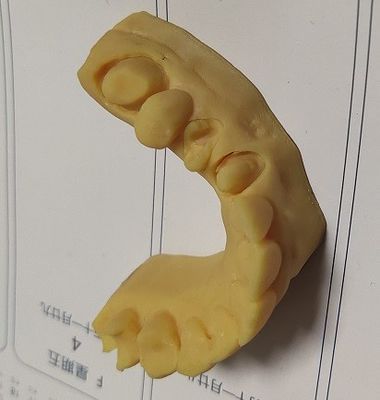 Hohes zahnmedizinisches Modell des Druckes 3D der Präzisions-ISO13485 Trushine