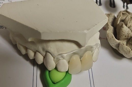 Vorübergehendes weiches und elastisches unsichtbares Gebiss Valplast