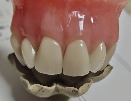 Ästhetik-volles Gebiss-kalte kurierte Acrylteilprothese