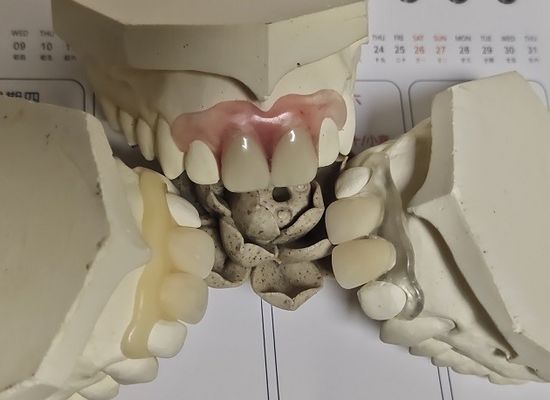 Bequemes weiches unsichtbares Gebiss des Sitz-ISO13485 RPD