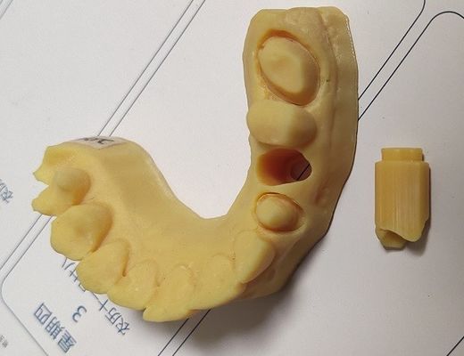 Hohes zahnmedizinisches Modell des Druckes 3D der Präzisions-ISO13485 Trushine