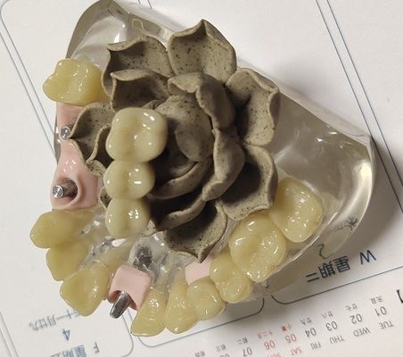 100 provisorische Krone Prozent Biocompatibility PMMA