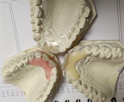 Vorübergehendes weiches und elastisches unsichtbares Gebiss Valplast