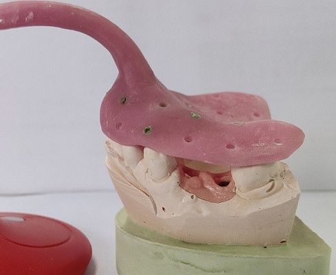 Kundenspezifische Gebiss-Eindrucks-Behälter