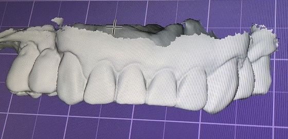 Spott 3D Digital herauf Zähne andere zahnmedizinische Produkte