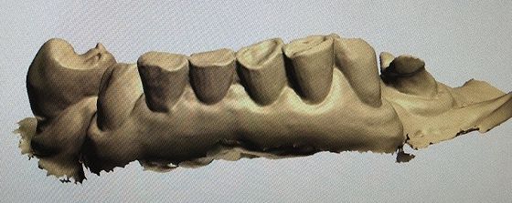 Spott 3D Digital herauf Zähne andere zahnmedizinische Produkte