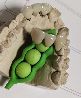 Cad-Nocken-Entwurfs-zahnmedizinischer Druck 3D