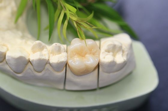 Entwurfs-zahnmedizinisches Labormonolithisches Zirkoniumdioxid-zahnmedizinische Krone für Molar-Seitenzähne