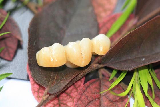 Entwurfs-zahnmedizinisches Labormonolithisches Zirkoniumdioxid-zahnmedizinische Krone für Molar-Seitenzähne