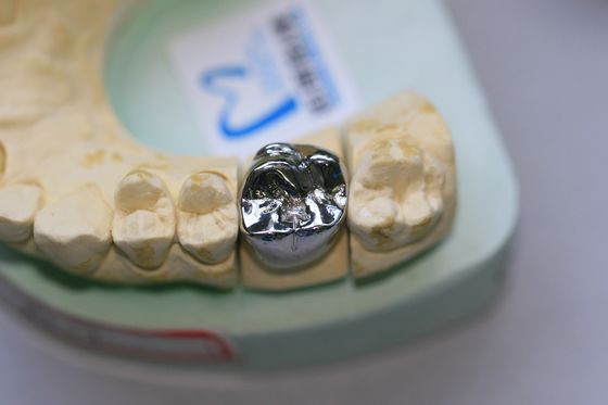 Volle Form-unedles Metall legiert zahnmedizinische Krone