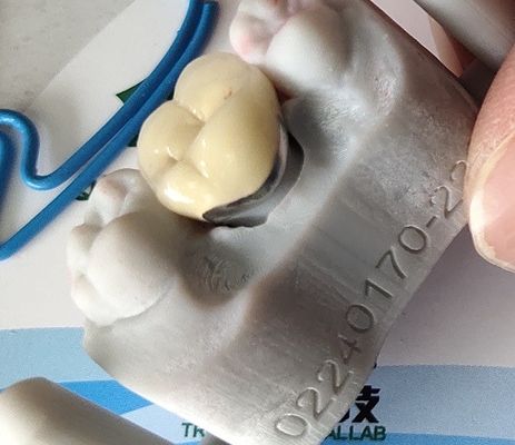 Zahnmedizinisches Kronenporzellan Laborprodukt CAD-Nockens PFM fixierte, um zu asphaltieren