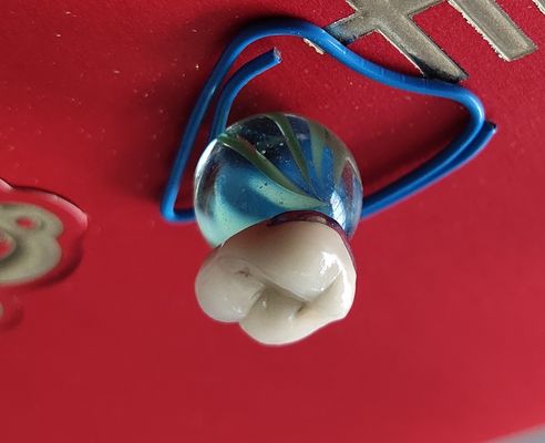 Zahnmedizinisches Kronenporzellan Laborprodukt CAD-Nockens PFM fixierte, um zu asphaltieren