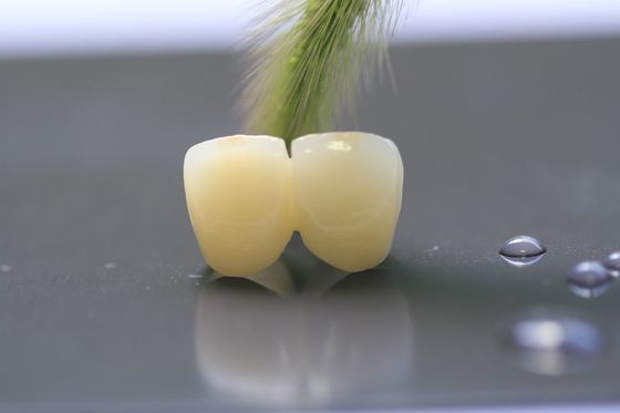 Laborkrone des Druck-3D zahnmedizinische des Rahmen-PFM für Zahnheilkunde